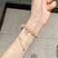 Nơ Thỏ Lấp Lánh Dây Điện Thoại Dây Tóc Cho Xiaomi Smart Band 10 Band 9 8 NFC Vòng Tay Thay Thế Dây Đeo Đồng Hồ Co Giãn