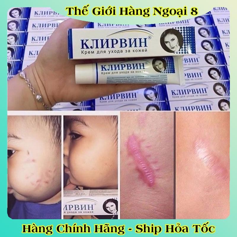 [DATE MỚI] Kem Sẹo KLIRVIN Nga Giảm Thâm Mờ Sẹo Rạn Da