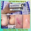 Kem Sẹo KLIRVIN Nga Giảm Thâm Mờ Sẹo Rạn Da