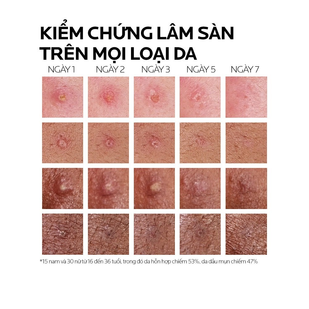 Kem Dưỡng Giảm Mụn Chỉ Sau 8H La Roche-Posay Effaclar Duo+ M 40ml