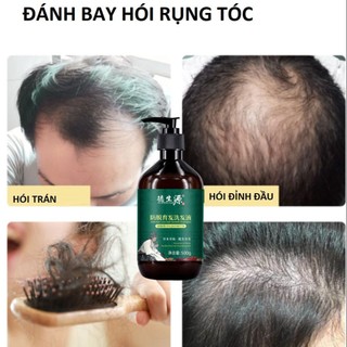 Dầu Gội Dược Hà Thủ Ô 500ml ( Mẫu Mới) giảm rụng tóc giảm bạc tóc kích thích mọc tóc Dầu gội thảo dược Hà Thủ Ô