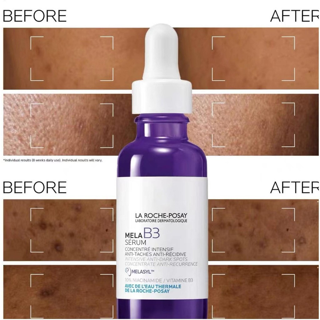 Tinh chất làm trắng da 30ml - Dầu dưỡng da mặt để làm mới phát sáng