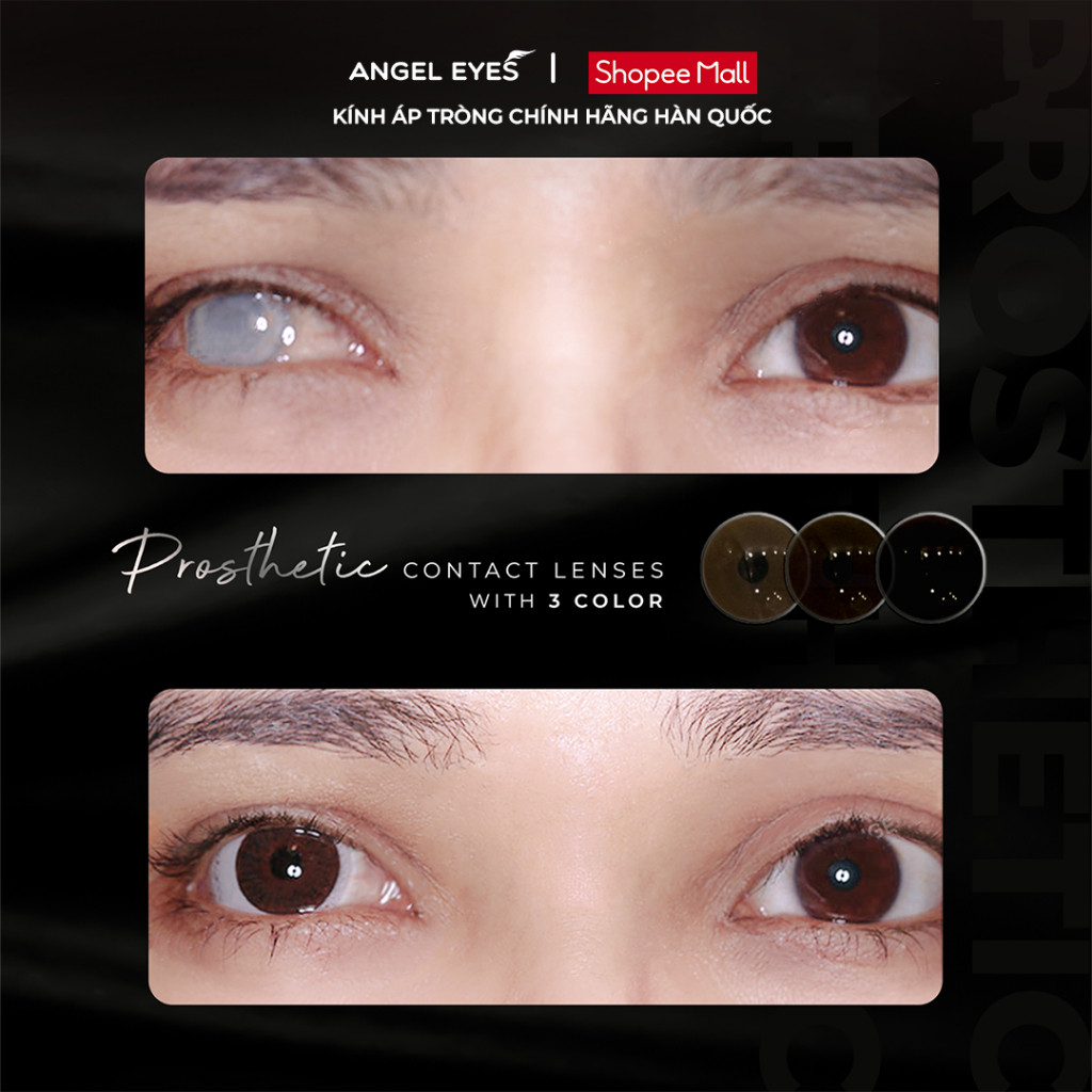 [HÀNG MỚI VỀ] Lens thẩm mỹ che khuyết điểm Angel Eyes, kính áp tròng thẩm mỹ cho mắt bị đục thủy tinh thế, kéo mây, cườm