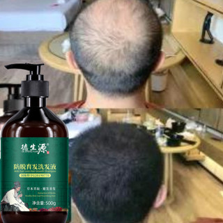 Dầu Gội Dược Hà Thủ Ô 500ml ( Mẫu Mới) giảm rụng tóc giảm bạc tóc kích thích mọc tóc Dầu gội thảo dược Hà Thủ Ô