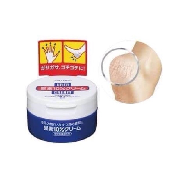 Kem chống nẻ gót chân tay Shisheido Urea cream Nhật Bản 100g, Kem bôi nẻ gót chân tay