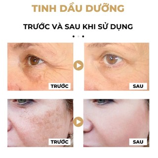 Tinh Dầu Nghệ 30Ml Serum Chăm Sóc Da Mặt Dưỡng Ẩm Dưỡng Ẩm Cải Thiện Tông Màu Da Chống Lão Hóa Làm Sáng Nếp Nhăn