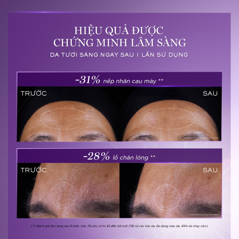 Serum Retinol Tươi 3 Lõi Rénergie Lancome - Giúp Tái Tạo Da Nhanh Gấp 2 Lần Với Retinol Thông Thường 50ml