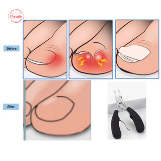 Diễu Hành Móng Chân Clippers Ingrown Ngón Chân Móng Tay Chịu Lực Chính Xác Móng Tay Mới VN