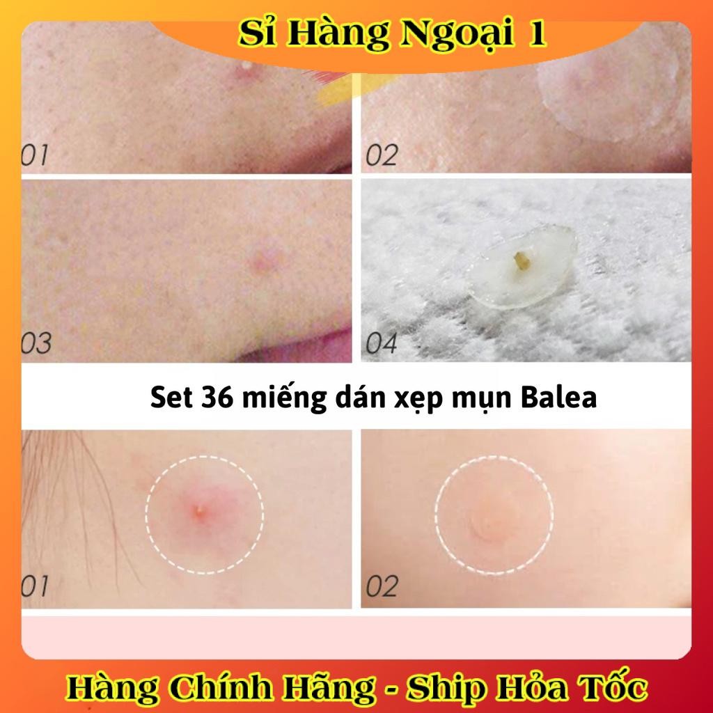 Miếng dán mụn Balea Anti-Pickel Patches Hautrein 36 miếng - Hàng nội địa Đức