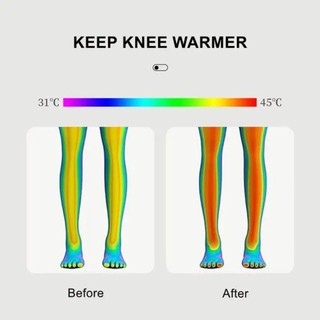YONDR 1 Cặp Nẹp Đầu Gối Co Giãn, Tấm Lót Đầu Gối Nén Nylon Patella Nẹp, Miếng Dán Bảo Vệ Khớp Chống Trơn Trượt Độ Đàn Hồi Cao Ánh Sáng Và Mỏng Thoáng Khí Đầu Gối Tay Bóng Rổ / Bóng Chuyền