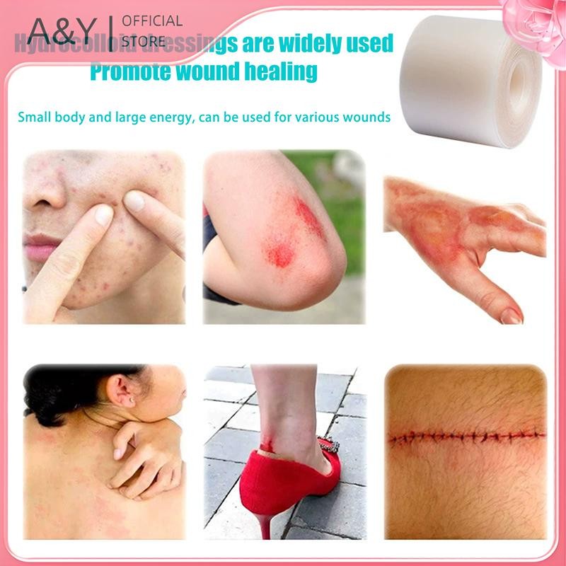 Băng cuộn & miếng dán thủy ngân A & Y Băng dính chăm sóc vết thương tự dính, thấm hút cao cho vết loét và bỏng giường