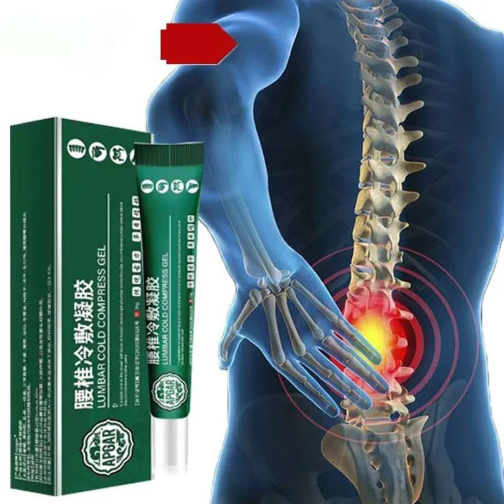 Gel Lạnh Bôi Vùng Thắt Lưng Thoát Vị Đĩa Đệm Thắt Lưng Viêm Thắt Cổ Tử Cung Kem Đau Lưng Viêm Khớp Do Đau Nhức