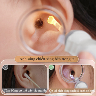 【BabyJoy】Bộ lấy ráy tai có đèn led thông minh,Dụng Cụ Vệ Sinh Tai Cho Bé,Thiết Kế Dành Cho Trẻ Em