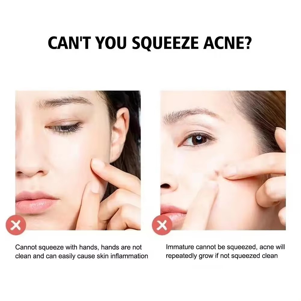 Bộ 4 Món Que Nặn Mụn Đầu Đen, Trứng Cá, Cám Thần Thánh Siêu Mịn Tế Bào Mụn Sạch Dụng Cụ