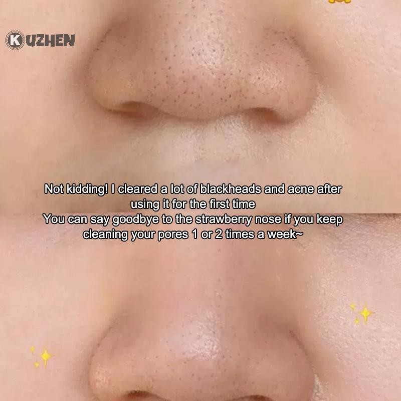 Máy chà sàn da mặt KUZHEN Tẩy mụn đầu đen có nắp mặt Thìa tẩy tế bào chết Làm sạch sâu Dụng cụ chăm sóc da HOT
