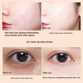 Kem che khuyết điểm MEIKO Cover Acne Marks, chuyên dụng cho nghệ sĩ, lâu trôi, che mụn, không loại bỏ