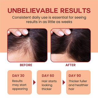 Batana Oil Hair Treatment 120ml Nourishing Hair Oil Balm for Shiny & Healthy Hair