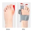 Dụng cụ chỉnh sửa ngón chân khiêm tốn, Dụng cụ chỉnh sửa móng chân Hallux Valgus Chăm sóc bàn chân Bunion, Dụng cụ chỉnh hình có thể xoay được có thể điều chỉnh ngón chân lớn