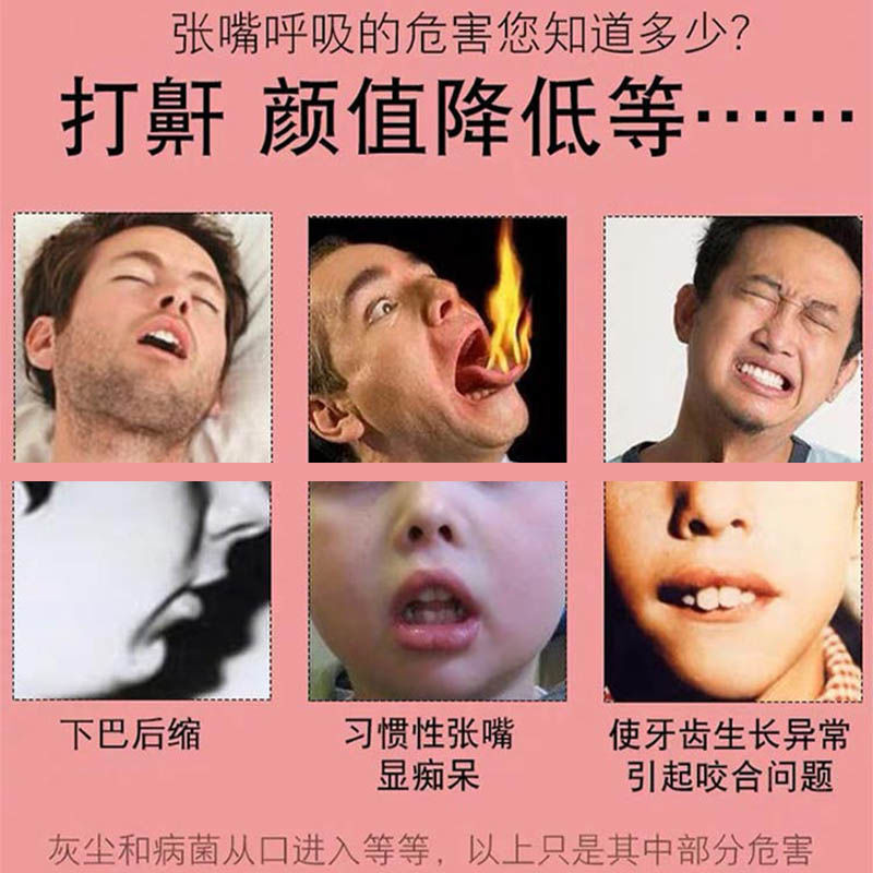 Nhật Bản Miệng Breath Corrector Ngủ Chống Mở Miệng Thở cằm Hỗ Trợ Đai Trẻ Em Người Lớn Mở Miệng Đóng Miệng Miếng Dán Đai Y