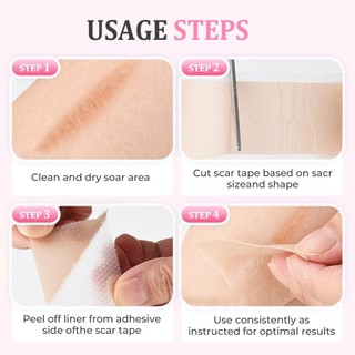 Tấm sẹo silicon cuộn 2026 Dải băng silicon mềm cho nếp nhăn mặt Mụn Keloid Bump Instant Plumping Thích hợp cho mọi làn da silicone đa năng phù hợp dùng cho gia đình căn hộ văn phòng và không gian nhỏ