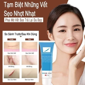 Kem xóa sẹo nhanh chóng, vết sẹo trầy xước, vết bỏng, vết thương sau phẫu thuật, vết rạn da tăng