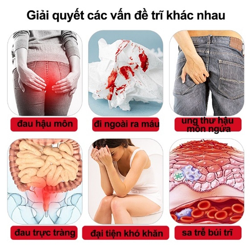 Kem Hỗ Trợ Bệnh Trĩ Chính Hãng, Giảm Sưng Đau Vùng Hậu Môn, Tiêu Sưng, Cầm Máu Và Làm Co Búi Trĩ, Dùng Cho Cả Nam Và