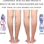 Tất nén bắp chân CQCJ, 2 cấp độ áp lực mở ngón chân, Tất y tá thoáng khí 20-30mmHg Giãn tĩnh mạch