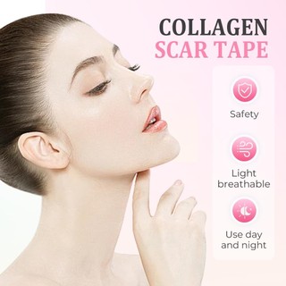Tấm sẹo silicon cuộn 2026 Dải băng silicon mềm cho nếp nhăn mặt Mụn Keloid Bump Instant Plumping Thích hợp cho mọi làn da silicone đa năng phù hợp dùng cho gia đình căn hộ văn phòng và không gian nhỏ