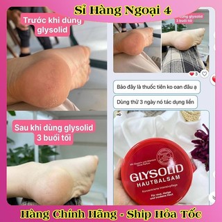 [auth] Kem dưỡng ẩm Glysolid Hautbalsam, 100 ml của Đức [Hot]