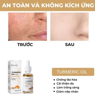 Tinh Dầu Nghệ 30Ml Serum Chăm Sóc Da Mặt Dưỡng Ẩm Dưỡng Ẩm Cải Thiện Tông Màu Da Chống Lão Hóa Làm Sáng Nếp Nhăn