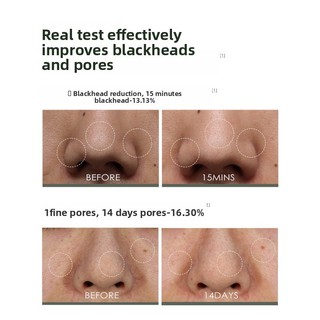 CAREKEEPS Mặt nạ bùn làm sạch Stick Loại bỏ đầu đen trắng Đóng mụn Mugwort Mặt nạ làm sạch sâu lỗ chân lông Thu nhỏ mặt nạ bùn
