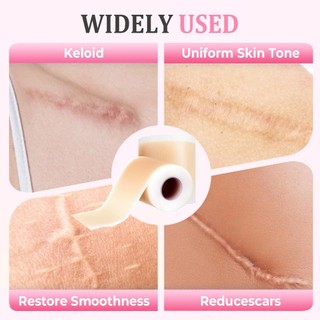 Tấm sẹo silicon cuộn 2026 Dải băng silicon mềm cho nếp nhăn mặt Mụn Keloid Bump Instant Plumping Thích hợp cho mọi làn da silicone đa năng phù hợp dùng cho gia đình căn hộ văn phòng và không gian nhỏ