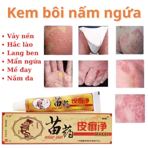 Kem Bôi Da Liễu chính hãng - Dùng cho Hắc Lào, Vảy Nến, Mề Đay, Ngứa Nấm và Lang Ben Hiệu quả