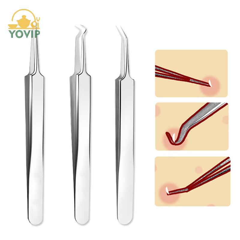 YOVIP Nhíp Kim Mụn Đầu Đen Loại Bỏ Mụn Đầu Nhọn Uốn Cong Dụng Cụ Chăm Sóc Mặt VN
