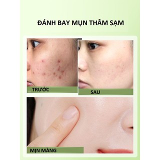 Sữa Rửa Mặt Tạo Bọt Bổ Sung Collagen 500g Làm Sạch Bụi Bẩn Bã Nhờn Chống Lão Hóa Bổ Sung Collagen Giúp Da Căng Mọng Da