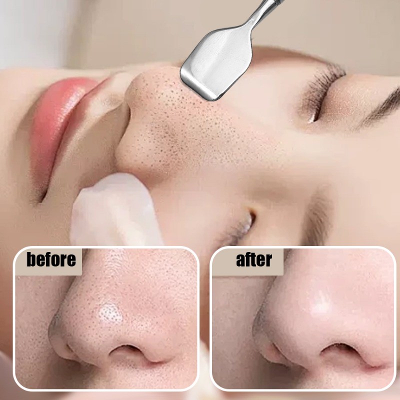 Xẻng Đầu Đen - Khuỷu Tay Dài, Thép Không Gỉ, Hai Đầu - Đẩy Đầu Đen Mũi - Vệ Sinh Cạo Mặt - Đa Năng, Di Động - Kim Mụn - Dụng Cụ Loại Bỏ Da Chết