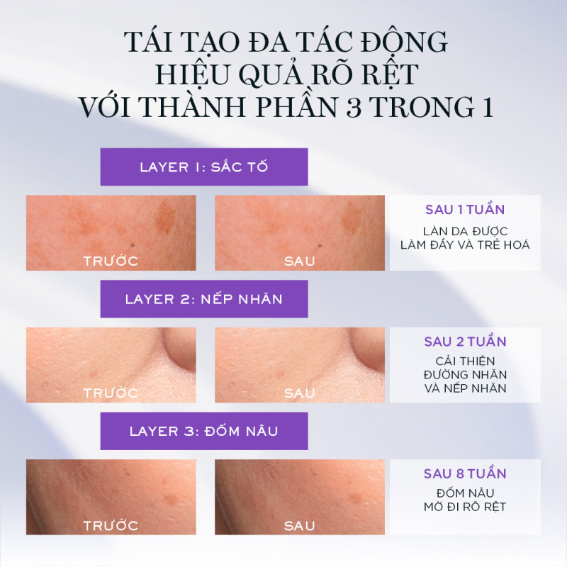 [KOL] Dưỡng Chất (Serum) Tươi 3 Lõi Ngăn Ngừa Lão Hóa Lancome Renergie Triple 50ml