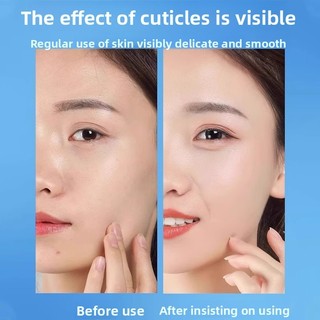 Chữa Tẩy Tế Bào Chết Gel Mặt Làm Sạch Sâu Lỗ Chân Lông Tẩy Tế Bào Chết Nhẹ Nhàng Kiểm Soát Dầu Dưỡng Ẩm Làm Mềm Da Mặt Tẩy Tế Bào Chết Gel