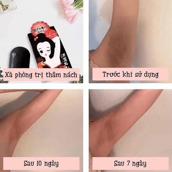 [DATE 2028] Xà Phòng Làm Mờ Thâm Nách Sáng Da 100g ,Giảm Thâm Vùng Da Dưới Cánh Tay