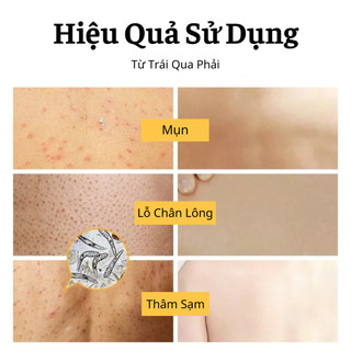 Sữa Tắm Trắng Da Sạch Mụn 500ml Làm Sạch Lưu Hương Lâu Làm Sạch Tận Sâu Lỗ Chân Lông Dưỡng Ẩm Trắng Sáng Mịn Màng