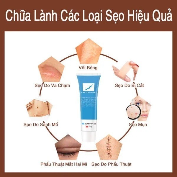 [CHÍNH HÃNG] Kem xóa sẹo nhanh chóng, vết sẹo trầy xước, vết bỏng, vết thương sau phẫu thuật, vết rạn da tăng
