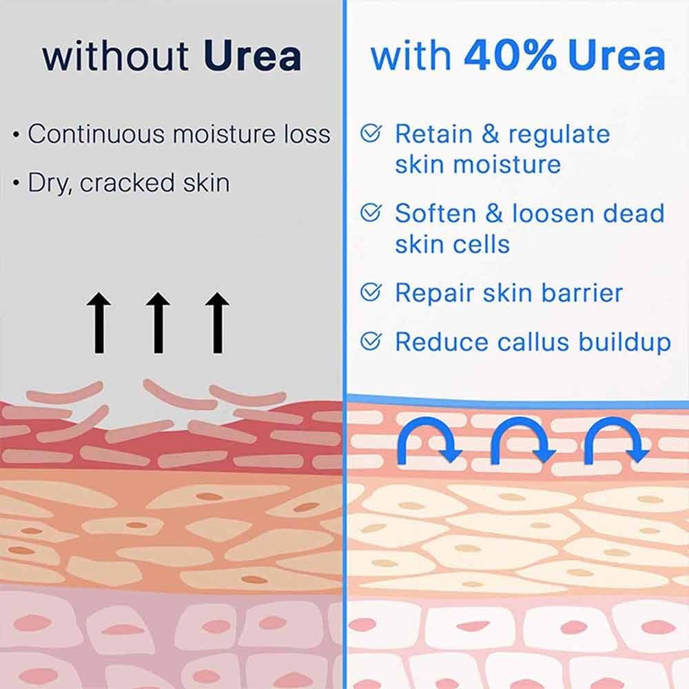 YURHERSU Urea Cream Moisturizing 50ml