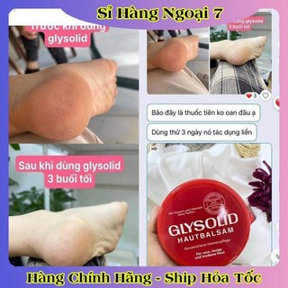 [auth] Kem dưỡng ẩm Glysolid Hautbalsam, 100 ml của Đức [Hot] .