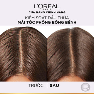 Bộ đôi gội xả nhẹ bồng mái tóc 72H Elseve HA Pure cho da đầu dầu hoặc Moist cho da đầu khô L'Oreal Paris 620ml, 375ml