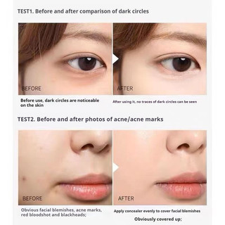 Kem che khuyết điểm MEIKO Cover Acne Marks, chuyên dụng cho nghệ sĩ, lâu trôi, che mụn, không loại bỏ