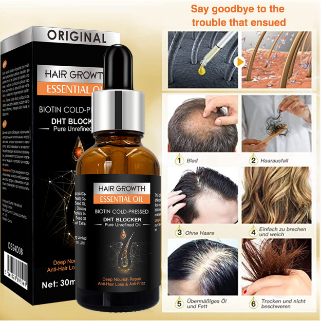 Serum Tinh Chất Mọc Tóc Giảm Gàu, Thảo Dược Kích Thích Mọc Tóc Giảm Nấm Ngứa , Bảo Tóc Chắc Khoẻ