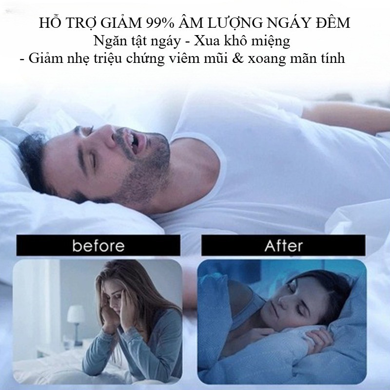 Miếng dán miệng khi ngủ chống ngáy hiệu quả hộp 30 miếng cải thiện giấc ngủ, chống hô cho trẻ em và người lớn