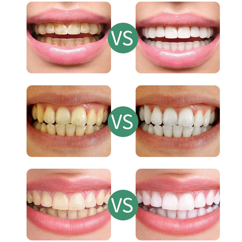 3 Cái / bộ Bàn Chải Làm Sạch Răng Bọt Biển Để Loại Bỏ Vết Bẩn Răng Đen Và Thiết Bị Làm Sạch Răng