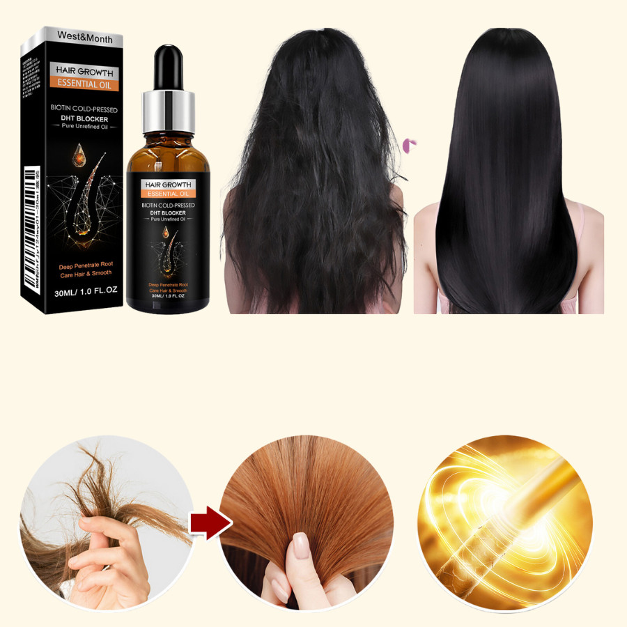 Serum Tinh Chất Mọc Tóc Giảm Gàu, Thảo Dược Kích Thích Mọc Tóc Giảm Nấm Ngứa , Bảo Tóc Chắc Khoẻ