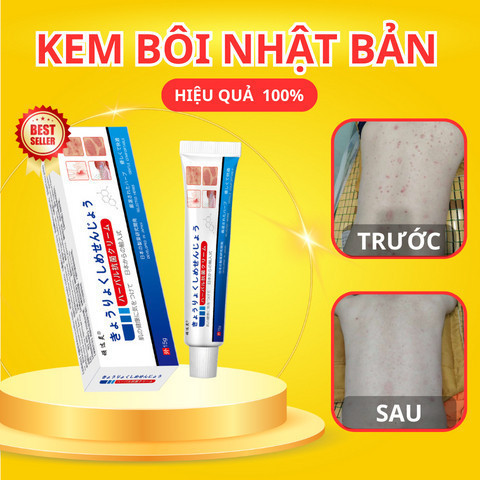 Kem Bôi Đa Năng NHẬT BẢN   Giảm Ngứa Tức Thì - Nấm Da, Hắc Lào, Tổ Đỉa, Vảy Nến | Thảo Dược Dịu Nhẹ, Không Kích Ứng